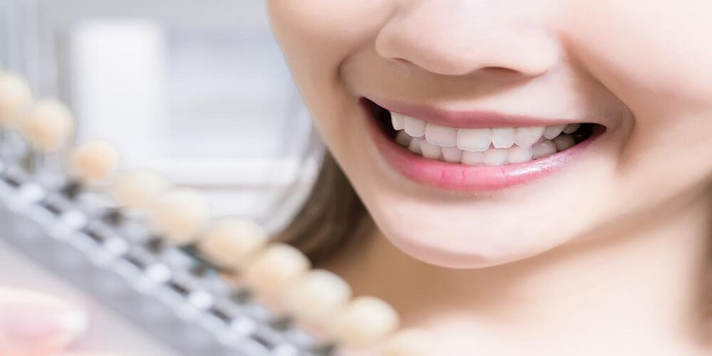 Don’t buy a teeth whitening product without reading this!